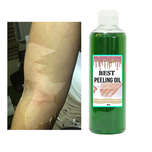 Best peeling Oil, Extra Strength Peeling Oil