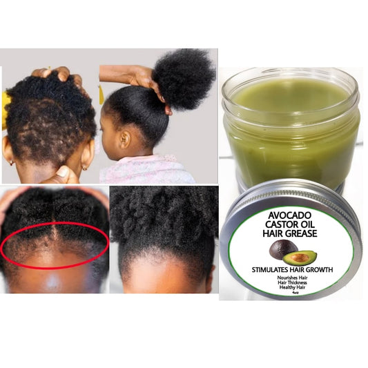 Avocado hair growth grease, thick hair , Healthy hair